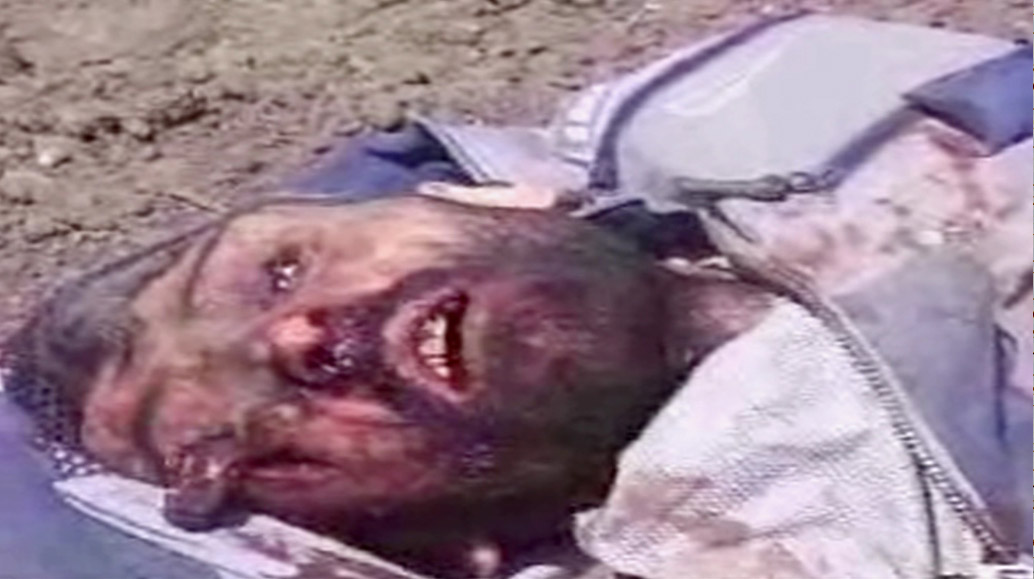 head with eye bulging out